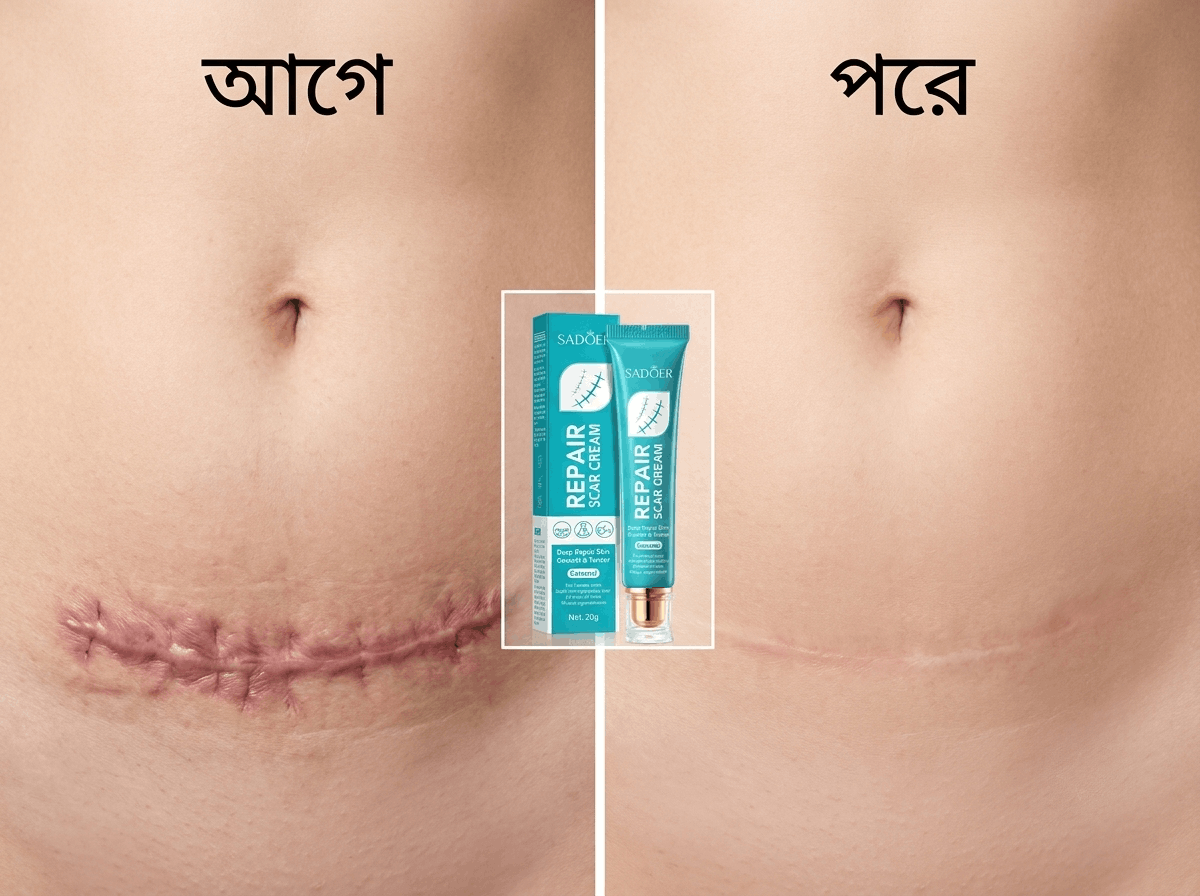 [সিজারিয়ান কাটা দাগ পূর্বে এবং পরে পরিবর্তন]