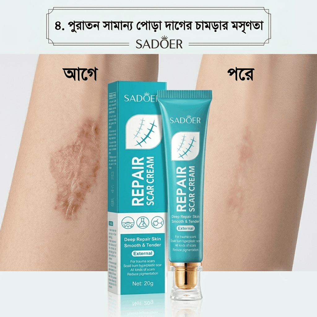[পুরাতন পোড়া দাগের চামড়ার মসৃণতা পূর্বে এবং পরে]