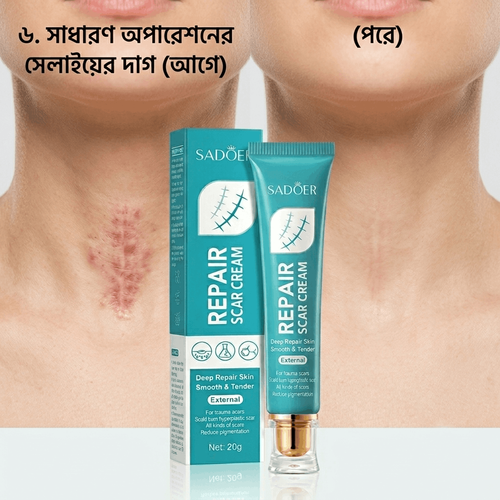 [গলার অপারেশনের সেলাইয়ের দাগ পূর্বে এবং পরে]