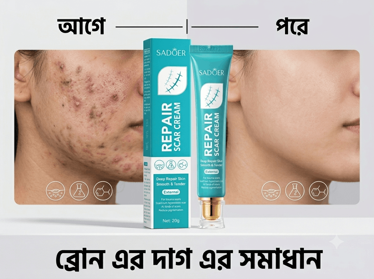 [ব্রণের কালো দাগ ও গর্ত]