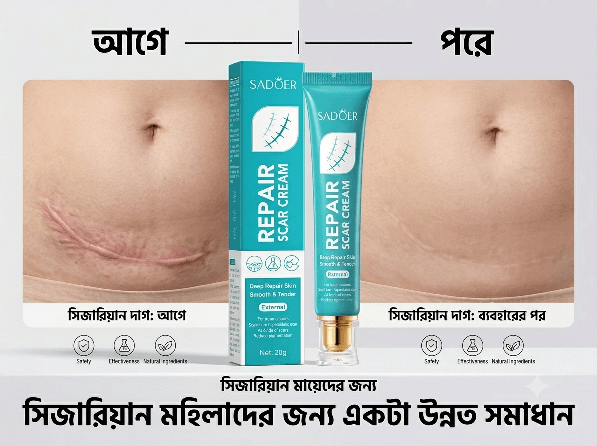 [সিজারিয়ান কাটা দাগ]